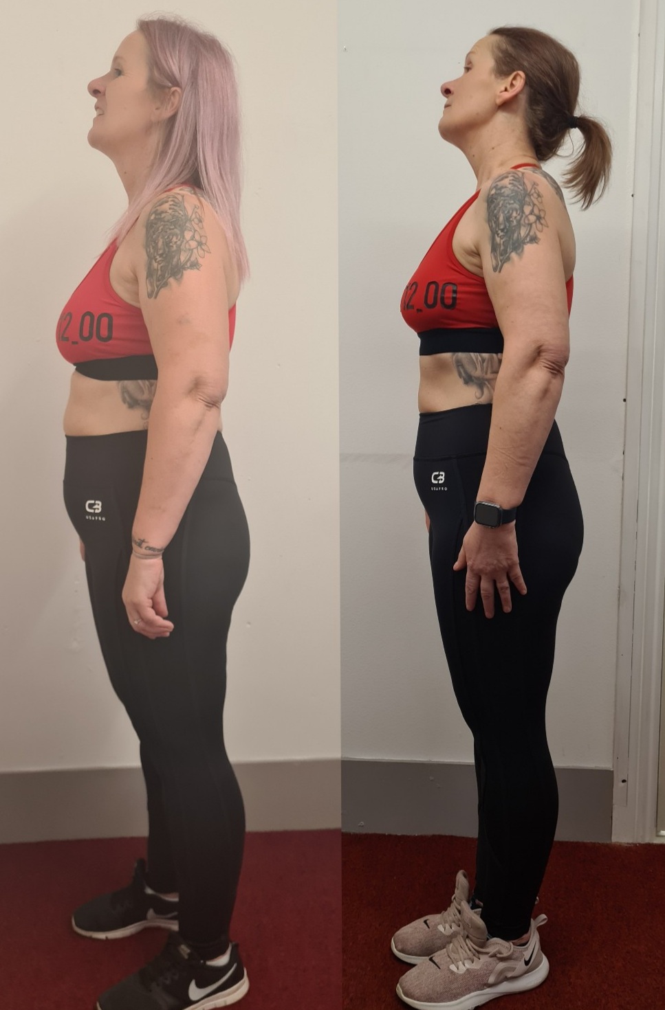Side-view before and after of a female client